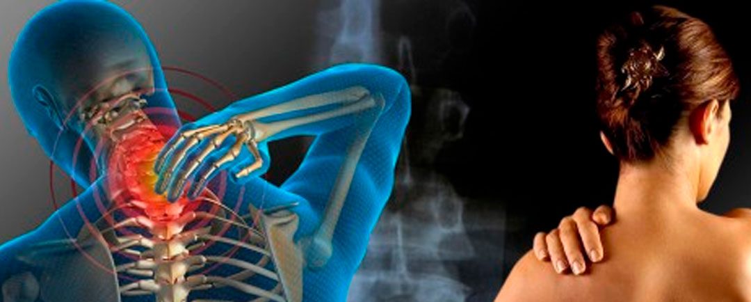 Los Trastornos Comunes de la Columna Vertebral, el Hombro y la Pelvis