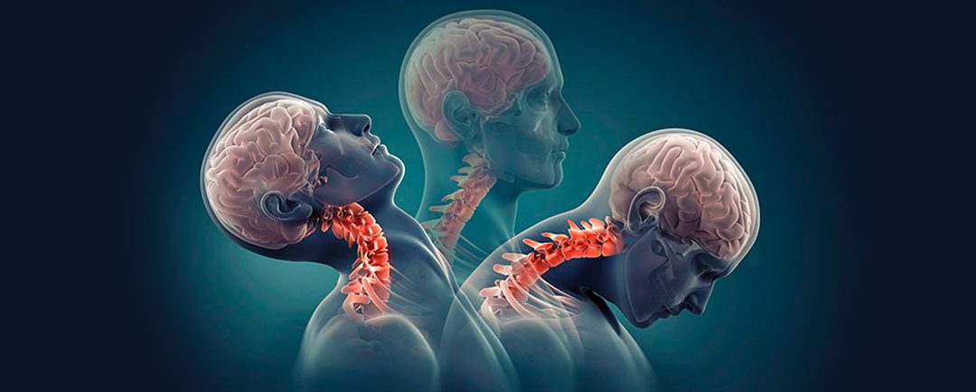Prevención de las Lesiones Cervicales