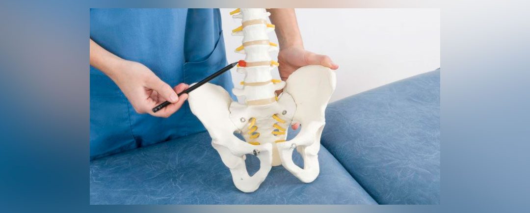 Riesgos de la Hernia Discal