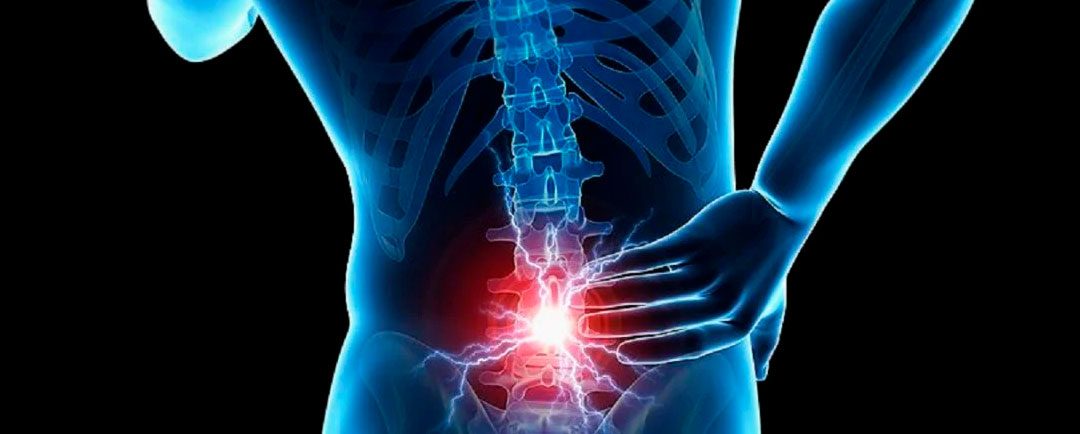 La Discopatía Degenerativa Lumbar