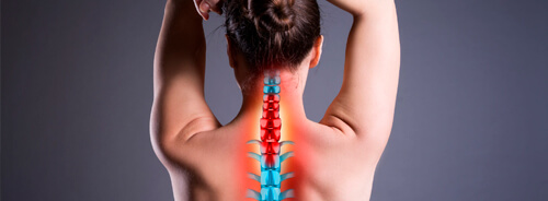 Niveles de la Hernia Discal