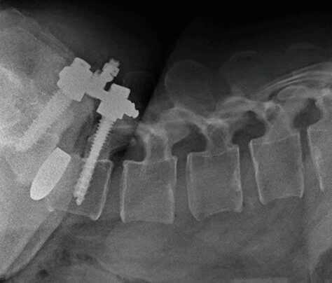 Cirugía de rodilla - Traumatólogo y Ortopedista