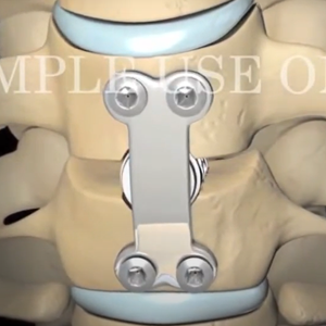 cirugía de columna - Traumatólogo y Ortopedista