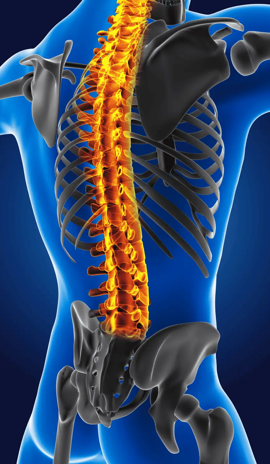 Modelo 3D de anatomía humana con dolor y fractura en la columna vertebral